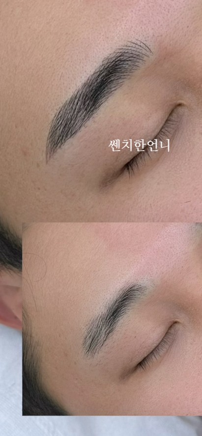 눈썹문신짱구
남자눈썹문신 시술직후