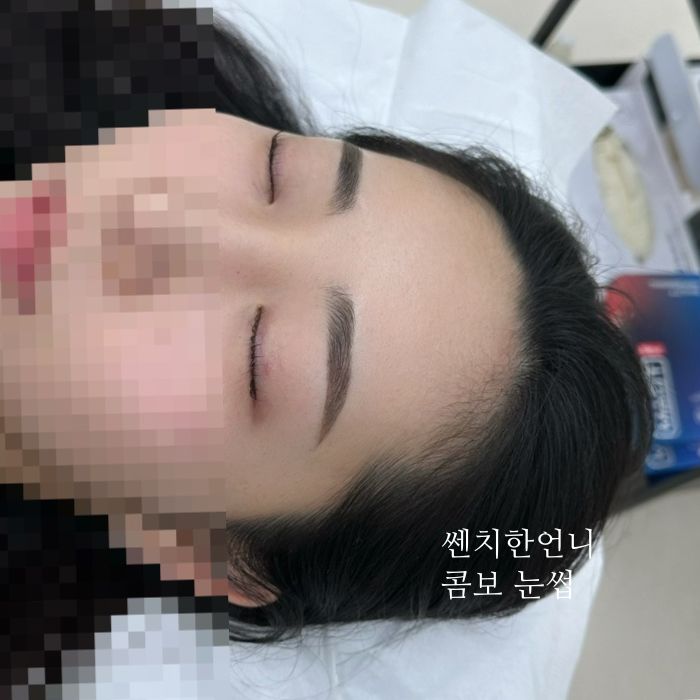 여자 콤보 눈썹 시술 후 사진