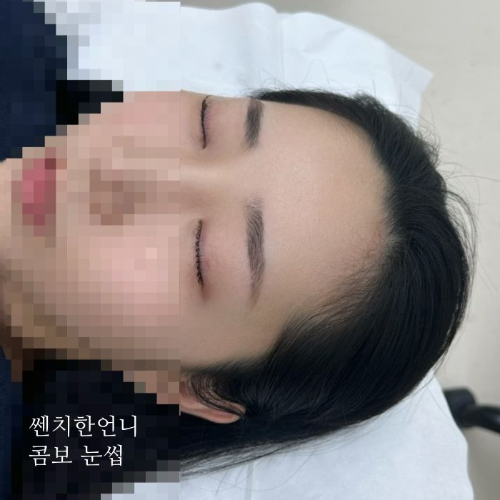 익산-눈썹-문신
여자 콤보 눈썹 시술 전 사진